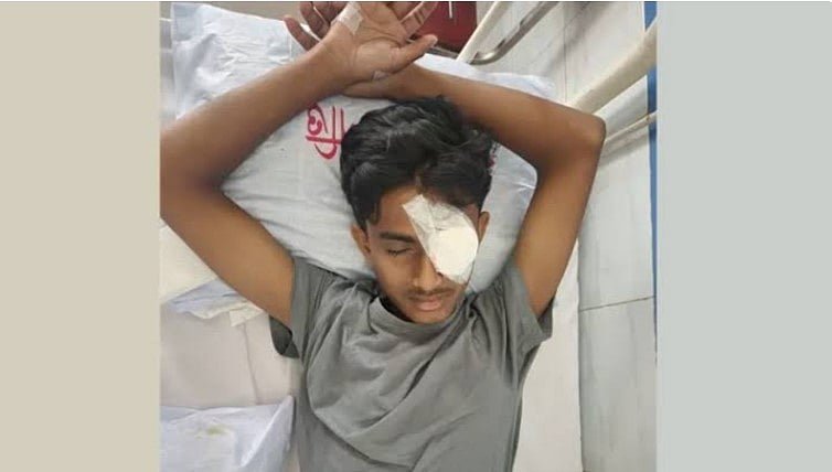 আলিফের রক্তাক্ত চোখ এবং ক্ষমতার জাহির