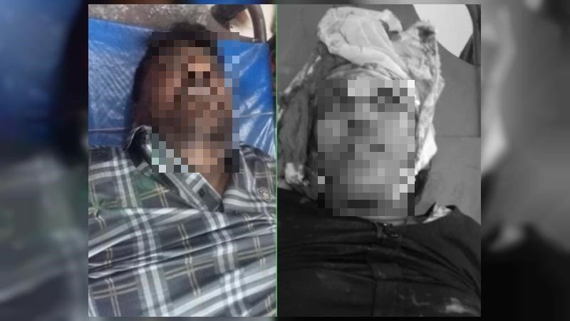 যশোরে ইজিবাইক-মোটরসাইকেল দূর্ঘটনায় মারা গেছেন স্বামী-স্ত্রী